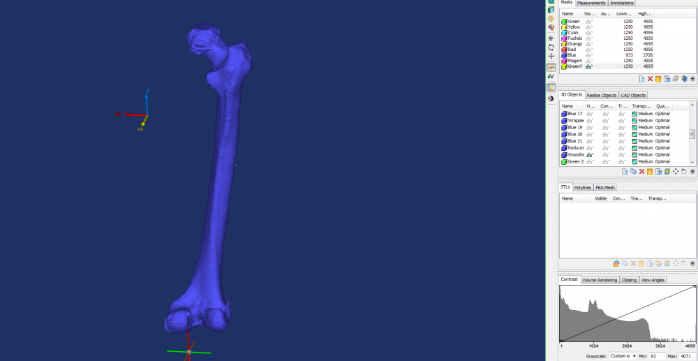 Femur.png